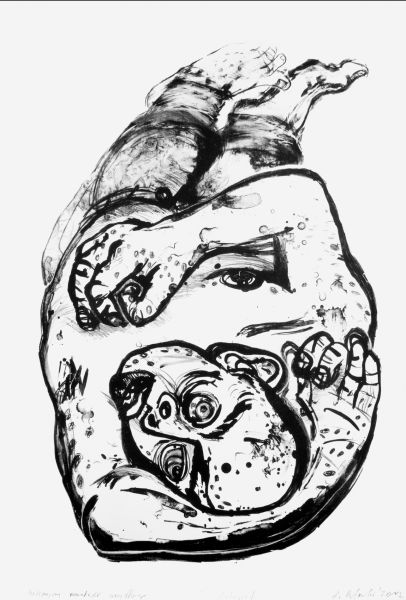 Łukasz Butowski – Postępujący nowotwór wszystkiego